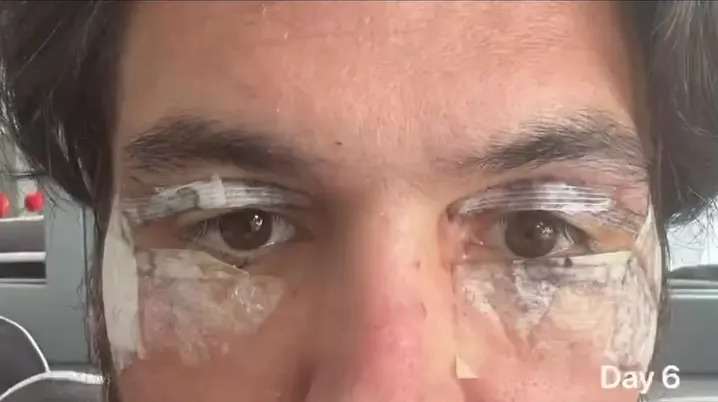 The former Towie man said he felt self-conscious about his appearance