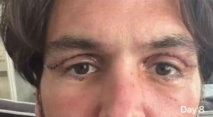 The star's surgery has healed well