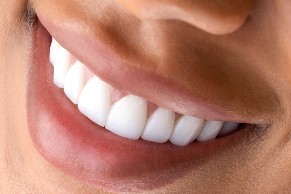 Close-up of a woman's smile showing healthy white teeth.