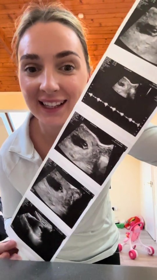 Woman holding up a series of ultrasound images.