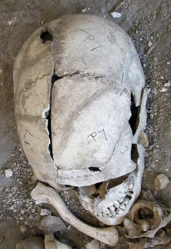 A fragmented skull and bone from a mass grave.