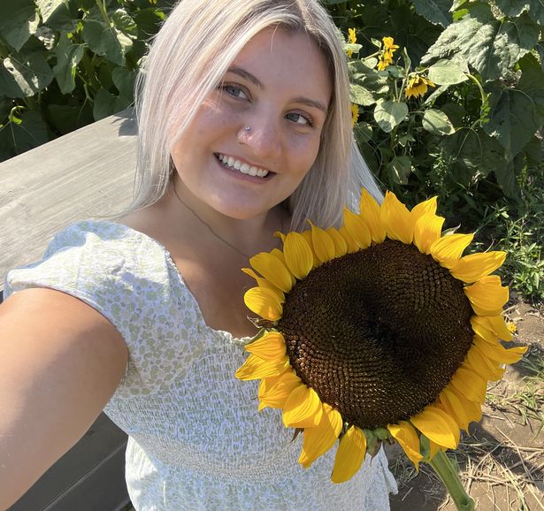 Ashlei suffered sun poisoning on her holiday