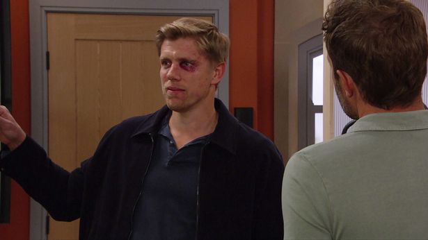 Robert Sugden faced rejection yet again in the latest episode of the ITV soap