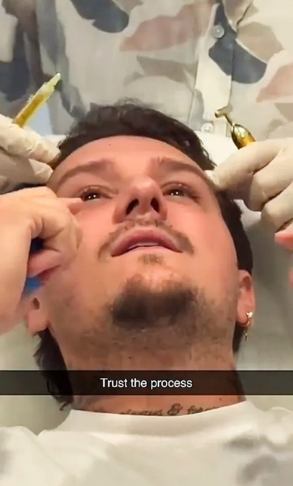 Man receiving a cosmetic procedure.