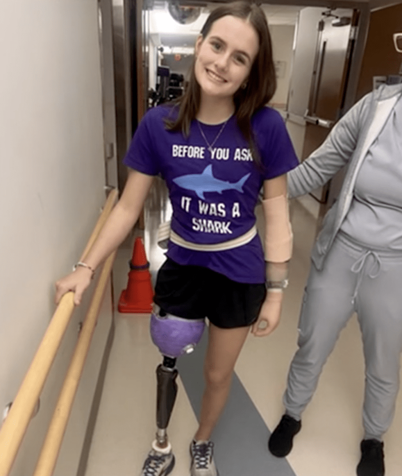 Lulu Gribbin, a shark attack survivor, wears a prosthetic leg and a shirt that says "Before You Ask It Was A Shark".