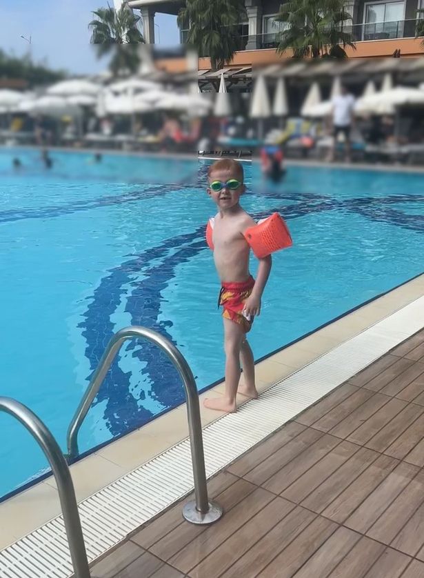 The youngster had been jumping into the pool, but one occasion led to the injury