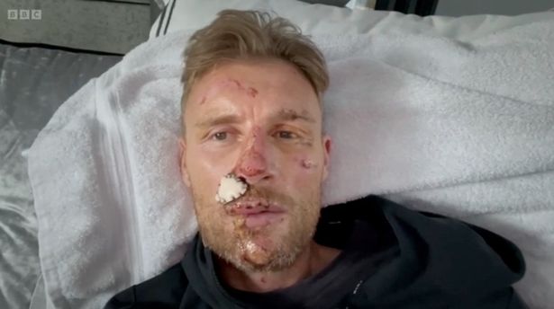 In Freddie Flintoff's Field of Dreams, the former cricketer is seen in hospital
